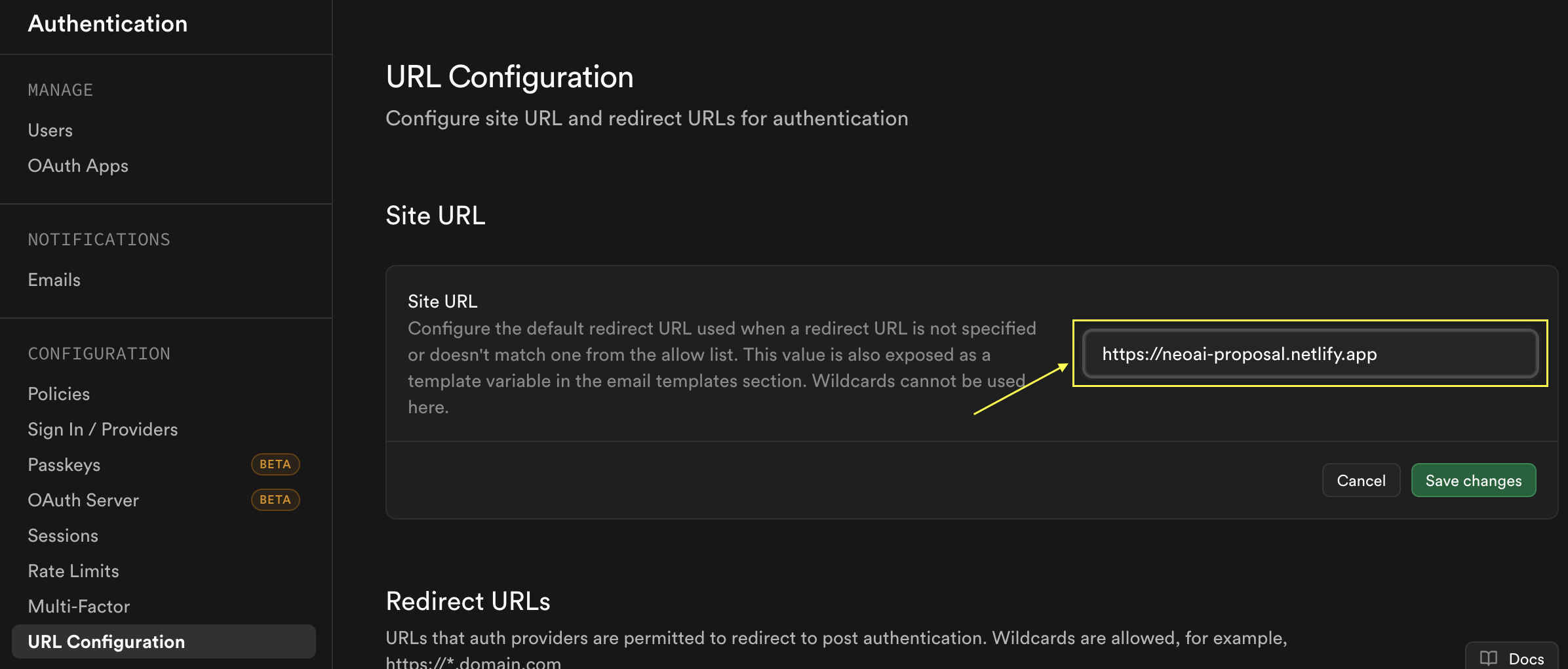 Supabase redirect URL screenshot